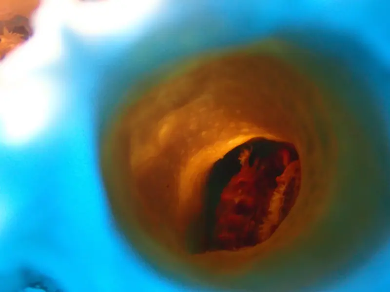 Red Ridged Clinging Crab (Mithraculus forceps)